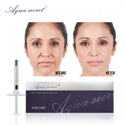 Facial wrinkles remove lip filler injections hyaluronic acid injectable filler