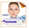 Younsofill CE ISO Clinic experiment double cross-linked non BDDE hyaluronic acid HA dermal filler injection