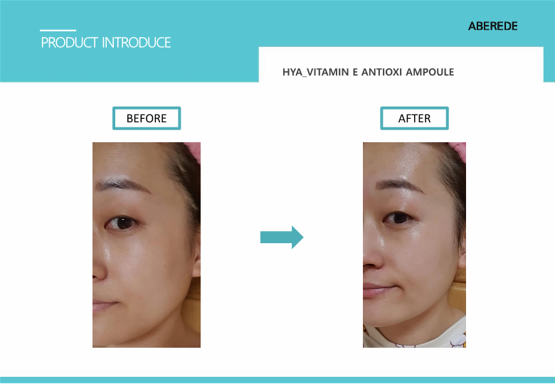 ABEREDE HYA_VITAMIN E ANTIOXI AMPOULE