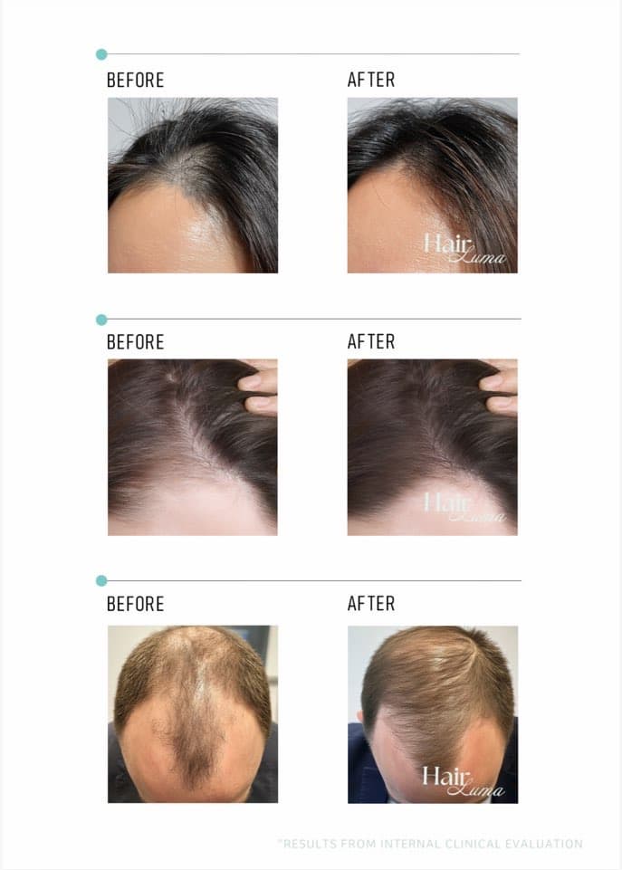 Hair Luma  Scalp, Hair care