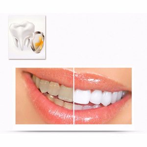 Teeth Whitening Activated Hydrogen Peroxide Pen