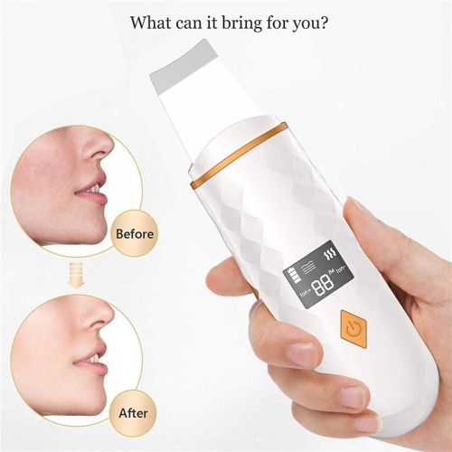 Perfect Idea Factory Portable Ion Ultrasound Facial Spatula Face Peeling Ultrasonic Skin Scrubber Ultrasonic Face Scrubber