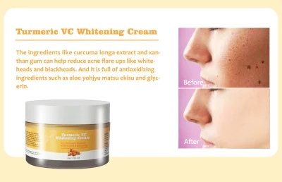 Beauty Cosmetics Skin Care Reduce Acne Blackheads Turmeric Vc Whitening Cream
