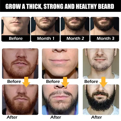 Hot Seller OEM Organic Beard Oil Deeply Moisturizes and Softens Beard Oil Men