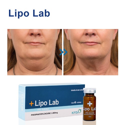 Lipo Lab Lipolysis fat dissolving injections for weight loss