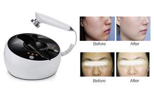MLAY factory price home use radio frequency rf beauty equipment
