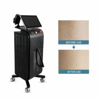 Big Power Diode Laser 755 808 1064nm Diode Laser Hair Removal Machine Price