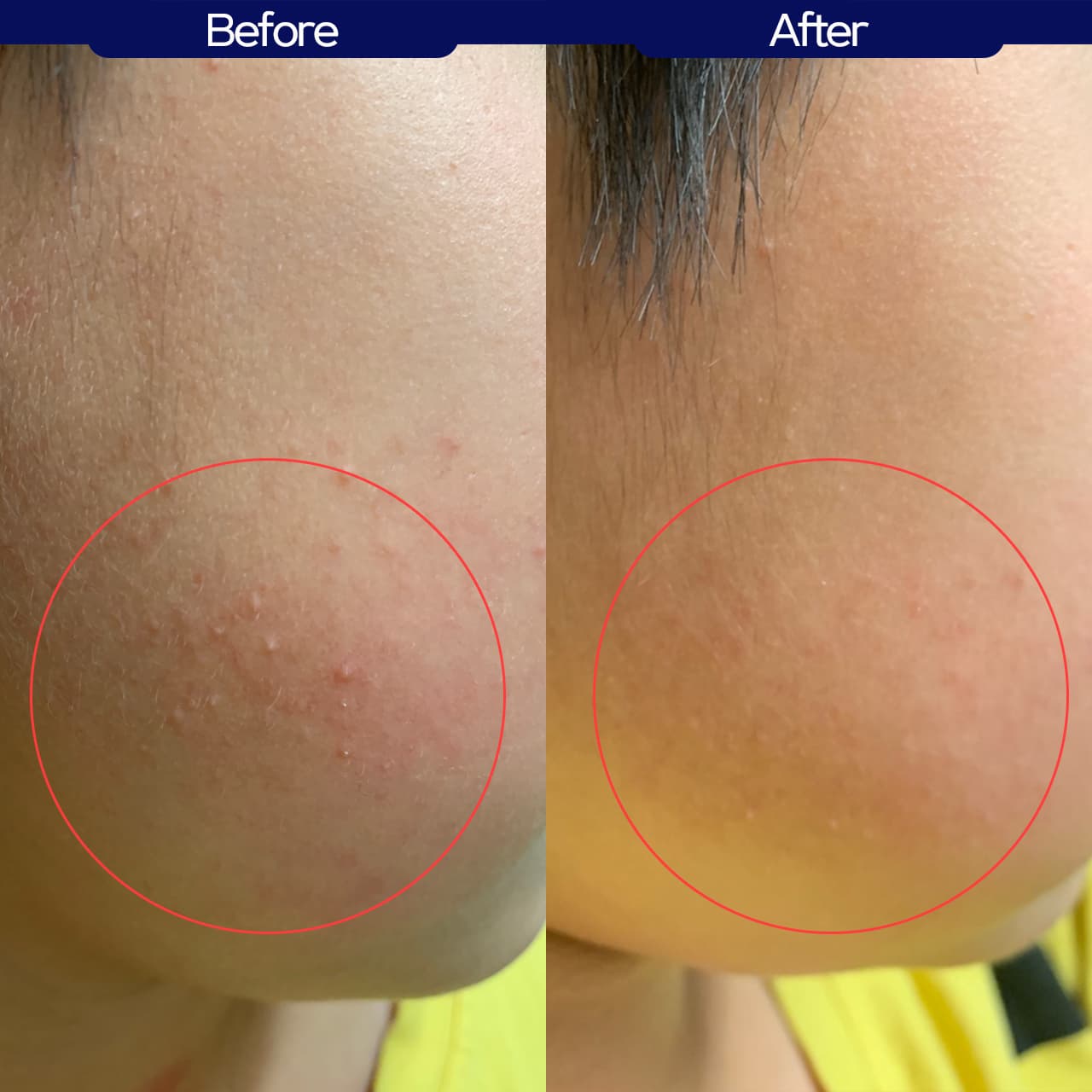 7 to 12 EORINY All in One Lotion 110ml