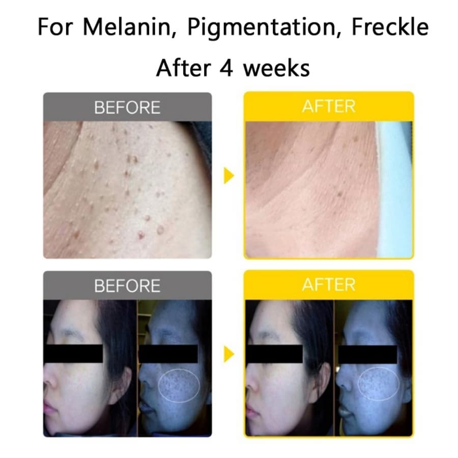 Pure Vitamin C 13.5% Ampoule