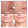 Korean Niacinamide Stem Cell Collagen Lifting Tightening Bakuchiol Age Defying Face Eye Ampoule Serum