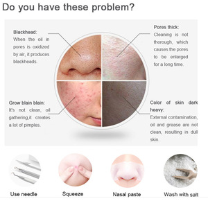 2019 New Cheap Skin care tool pore cleansing blackhead vacuum suction acne removal blackhead remover vacuum