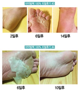 foot mask socks for pedicure exfoliator socks renewal for Peeling Noske feet Care Dead skin remover baby foot made in korea