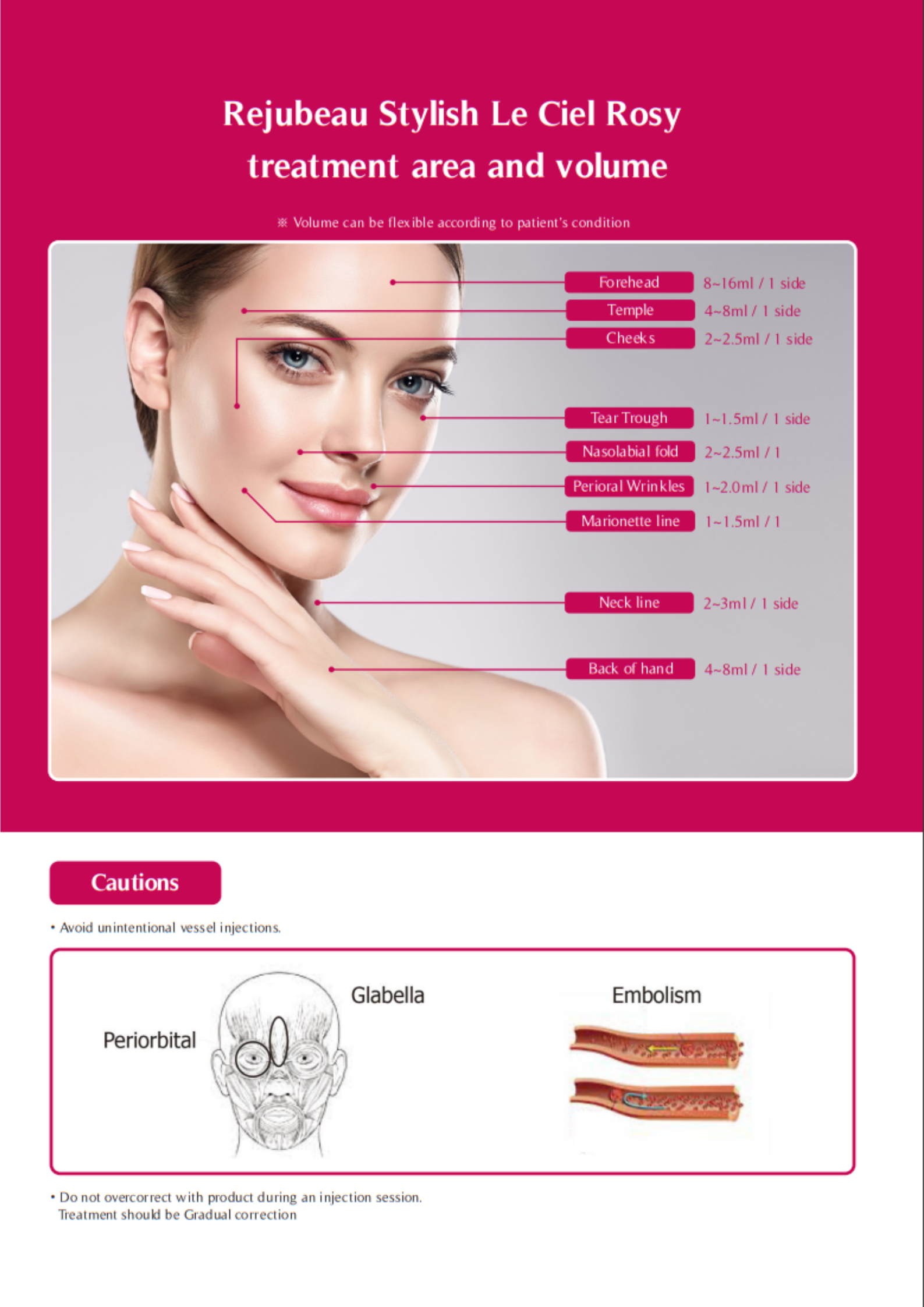 Le Ciel Rosy 365mg (PLLA)