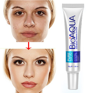 OEM 30g Bioaqua Best Pimples Removal Face Acne Treatment and Anti Acne Cream