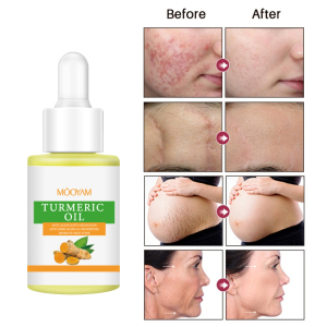 Private Label Organic Whitening Turmeric Essential Oil  Anti-Aging Anti Acne Turmeric Facial Face Oil