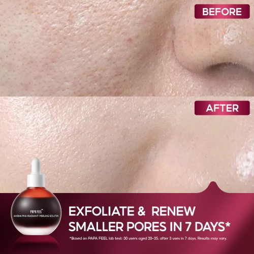 SKINCARE PAPA FEEL AHA BHA PHA Intensive Peeling Serum | Anti-Acne Blackhead Removal Pore Minimizing 30ml