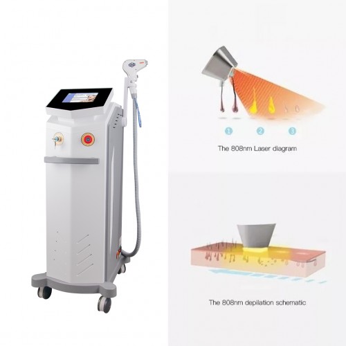 Top Quality 755nm 808nm 1064nm Professional Painless Permanent Alexandrite Laser Device