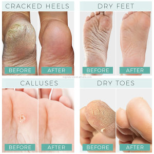 Private Label Foot Peel Mask Smooth Skin, Removes & Repairs Rough Heels Exfoliating Peeling Natural Treatment Foot Mask