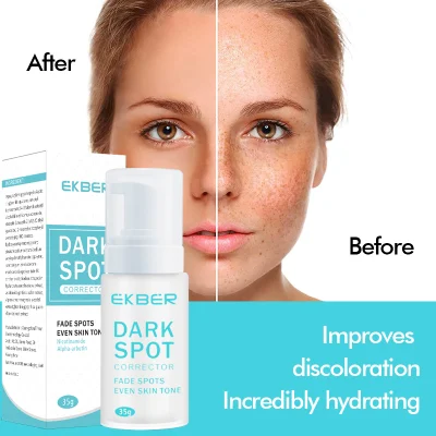 Wholesale Best Skin Care Whitening Face Care Removal Dark Spot Corrector Face Cream Treatment Cosmetic Skin Care Beauty Products Lightening Cosmetics Remove