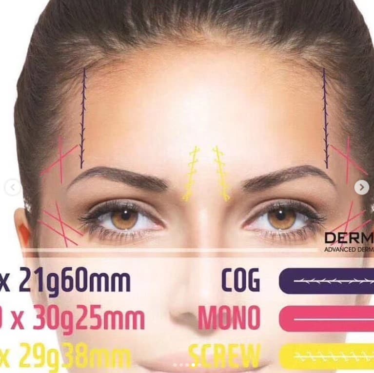 DERMA V LINE LIFTING THREAD SKIN LIFTING