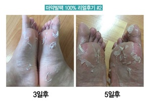 foot mask socks for pedicure exfoliator socks renewal for Peeling Noske feet Care Dead skin remover baby foot made in korea