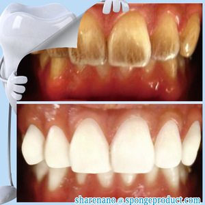 Hot Sell Popular Remove Stains oral hygiene Best professional dental whitening products