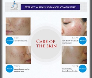 OEM 30g Bioaqua Best Pimples Removal Face Acne Treatment and Anti Acne Cream