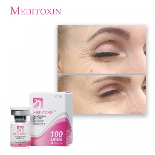 Wholesale dermal filler Hyaluronic Acid 100u 200u botulax toxin for sale