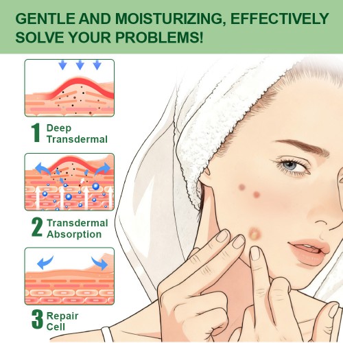 Aloe Vera Skin Care Ointment, Sebaceous Gland Mass Fat Health Care Cream