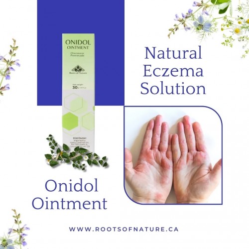 Onidol – The Natural & Safe Solution for Eczema Relief