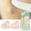 Aloe Vera Skin Care Ointment, Sebaceous Gland Mass Fat Health Care Cream
