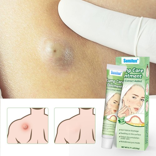 Aloe Vera Skin Care Ointment, Sebaceous Gland Mass Fat Health Care Cream