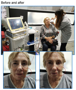 anti-wrinkle machine face lift equipment 12 lines High intensity focused ultrasound 3d hifu