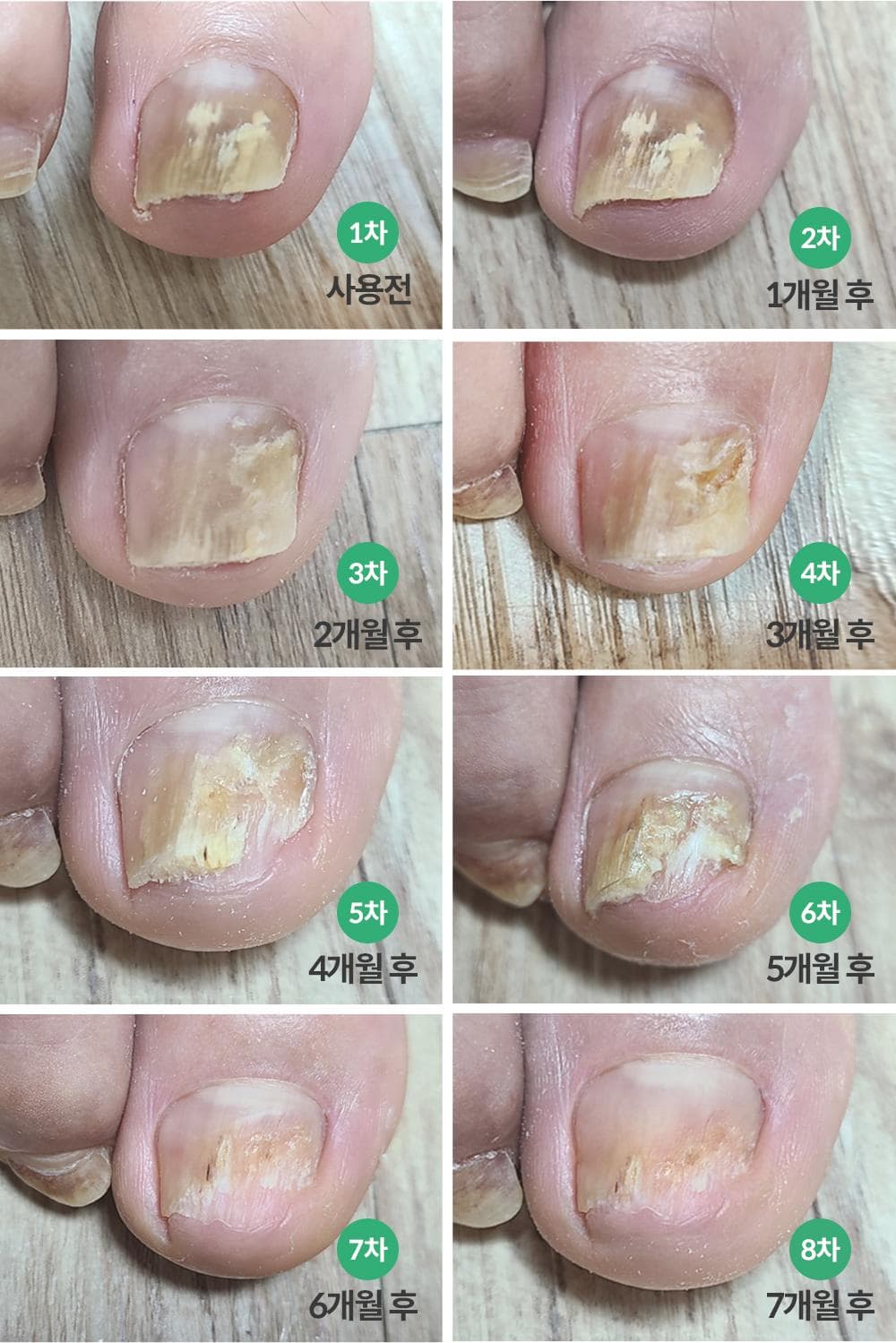 Dr.kralle PEDI SAVER toenail serum for damaged nail , organic ingredients , nail care , 15ml