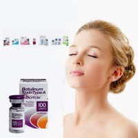 botox injection 100iu 150iu