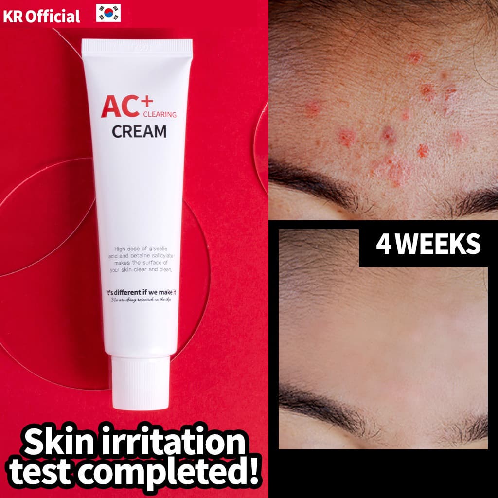 Anti-Acne Cream