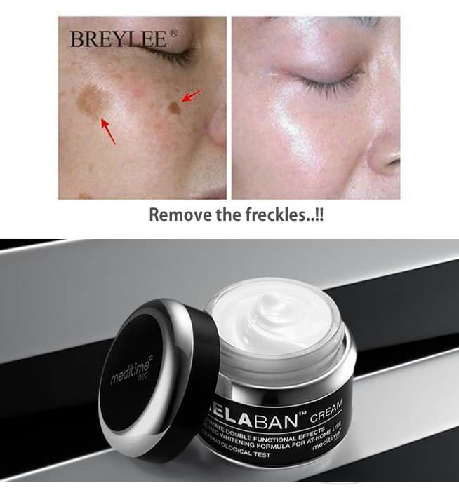MELABAN Cream for the Freckles & Dark Age Spots 50g