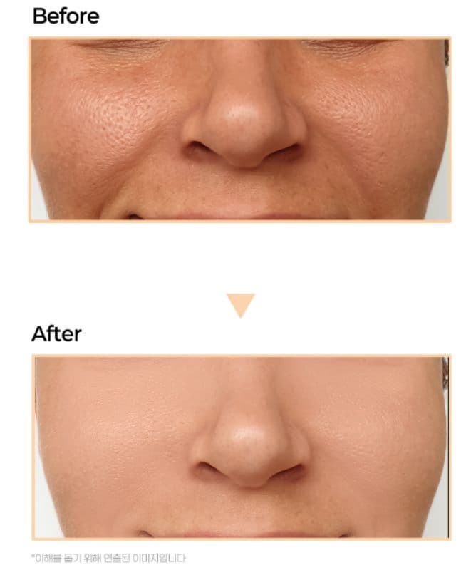 Vitamin Elasticity Ampoule 