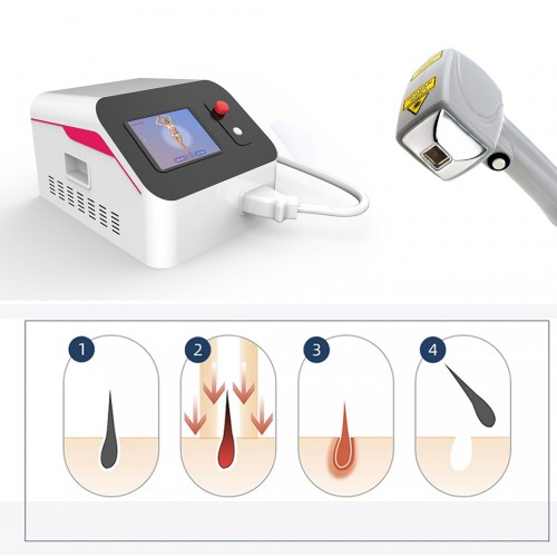 Portable Powerful Picosecond Laser/Picosecond Pico Laser Pigment Removal Tattoo Removal Pico Laser Machine