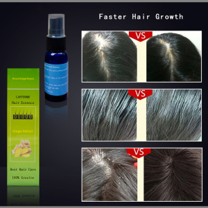 LANTHOME 30ml Natural Ginger Extract Hair Growth Serum Nursing Ginger Germinal Hair Oil