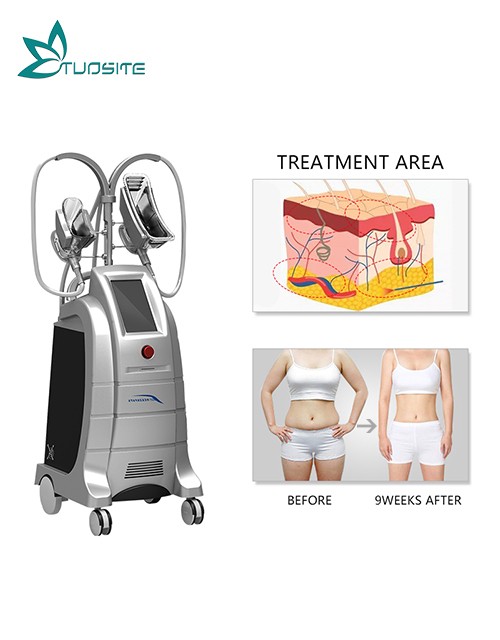 lose weight fast cryolipolysis slimming machine for salon use