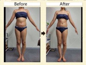 Elaimei Fat Burn Weight Loss Anti Cellulite Best Body Slimming Cream Gel