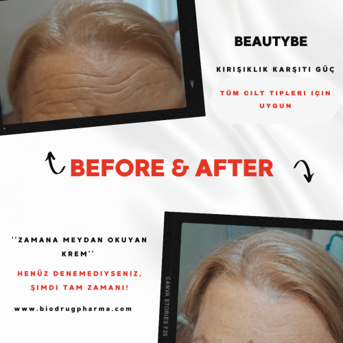 Beautybe Botox Cream with Instant Effect