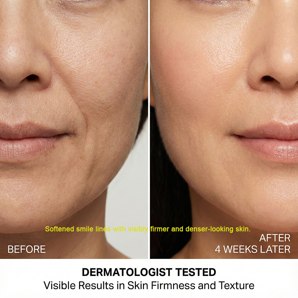 09. DEW BLANC PDRN  Smile Line Cream Intensive