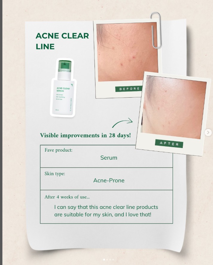 ACNE CLEAR SERUM