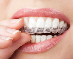 Thermoforming Dental Mouthguard Teeth Whitening Trays Bleaching Tooth Whitener Mouth Guard Care Oral Hygiene