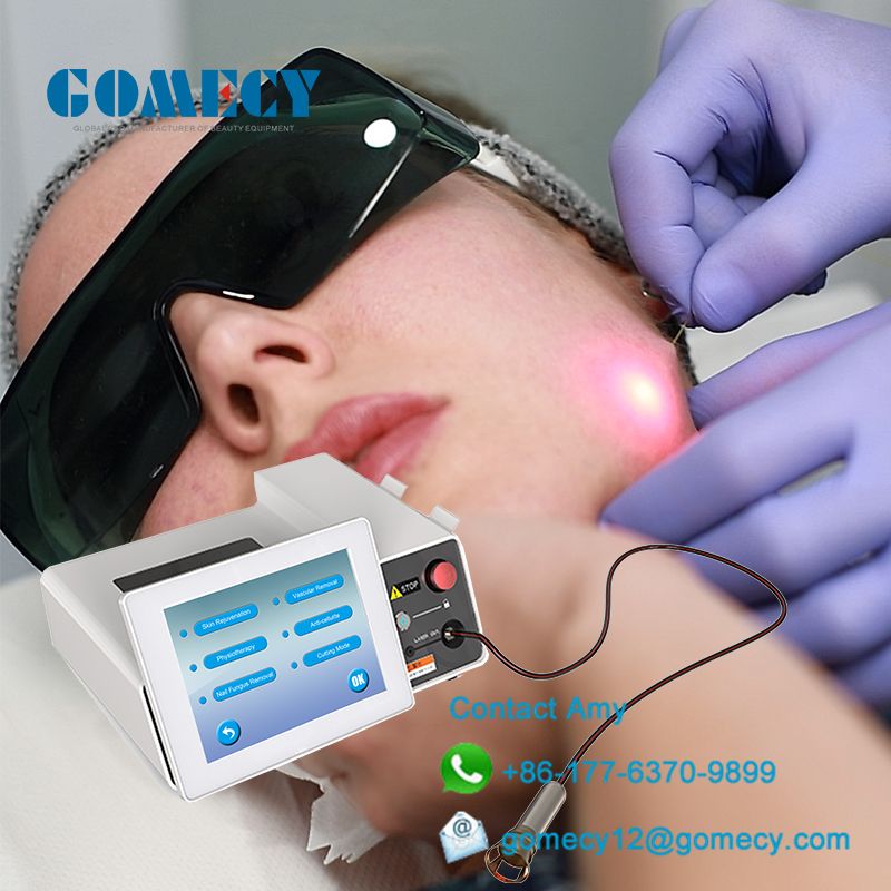 1470nm 980nm diode laser endolifting lipoysis therapy dental vascular removal machine
