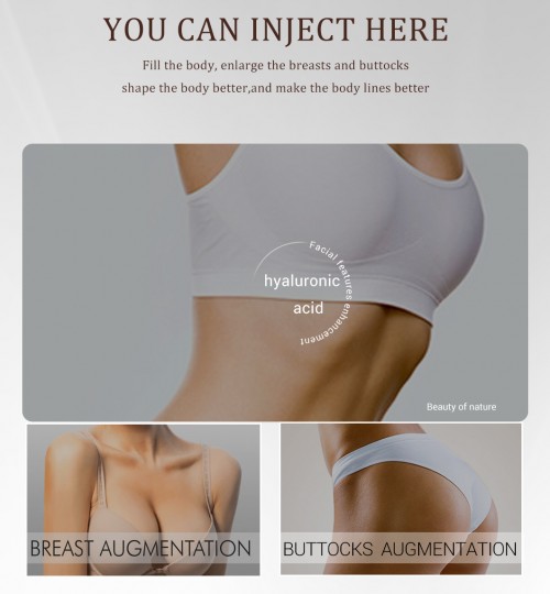 Hyaluronic Acid Dermal Fillers for Long-Lasting S-Curve Shaping