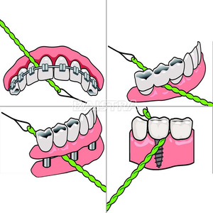 AZDENT Cheap Price Implant and Bridge Used Colored Green Dental Floss