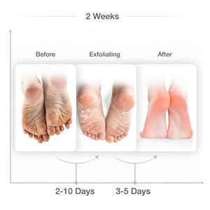 Dead Skin Removal Foot Care Mask Feet Peeling Exfoliation Foot Mask